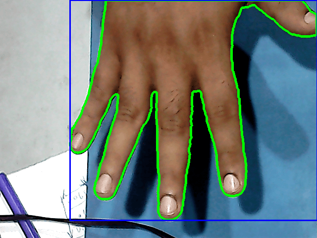 Hand Image Segmentation