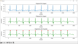 ECG R peaks detected with Python code